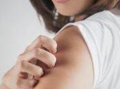 Rascarse piel, síntoma ansiedad pocos reconocen