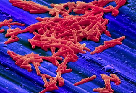 Superbug Clostridium Difficile está a punto de superar MRSA en hospitales Superbug Clostridium Difficile está a punto de superar MRSA en hospitales