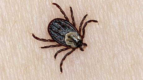 Enfermedad transmitidas por Rickettsial Tick Borne Enfermedad transmitidas por Rickettsial Tick Borne