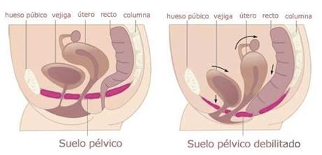 Incontinencia Urinaria, busca tu solucion.