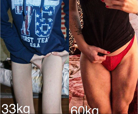 ¡Increíble transformación!De joven anoréxica a diosa fitness