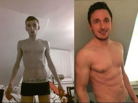 Hombre de 24 años le ganó su batalla a la anorexia en 4 meses gracias al culturismo
