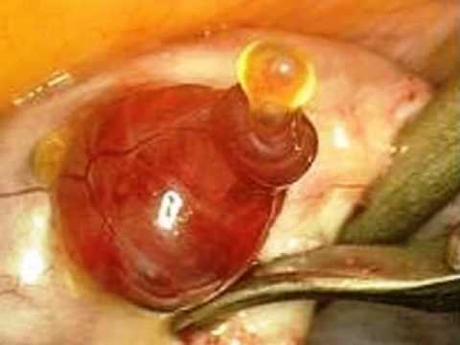 Sistema Reproductor (II)