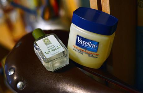 ¿Cómo prevenir y tratar heridas debido a la rozadura del sillín?