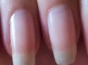 este remedio uñas crecerán como nunca, estarán fuertes