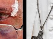 Colombia: Papa Francisco sangra luego sufrir golpe