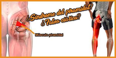 Sindrome del piramidal ¿Falsa ciática? Solución para ello