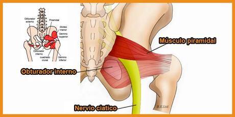 Sindrome del piramidal ¿Falsa ciática? Solución para ello