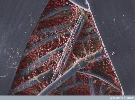 Premios Wellcome Images 2011