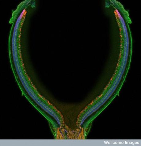 Premios Wellcome Images 2011