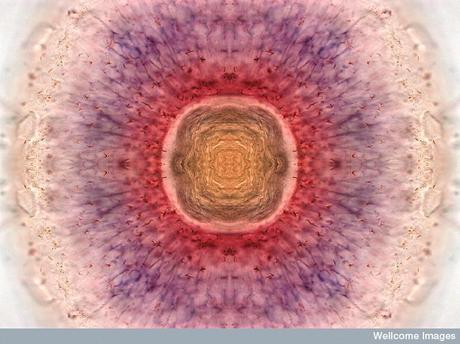 Premios Wellcome Images 2011