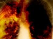 Nuevos avances tratamientos contra cáncer pulmón