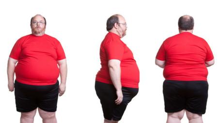Inhibir la obesidad mediante el aumento de una enzima intestinal