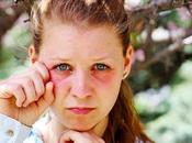 Ojos hinchados hinchazón periorbitaria