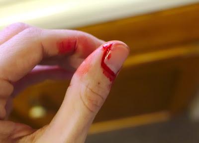 Fobia a la sangre y a las agujas Fobia a la sangre y a las agujas