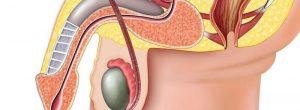La prostatitis no siempre es obvia Causas del monorquismo: tener sólo un testículo