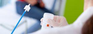 Apoyo a la familia y amigos: consejos para afrontar el cáncer en un ser querido Prueba de Papanicolaou: prueba de anomalías