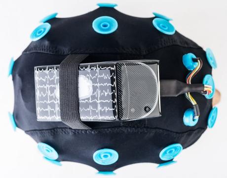 Neurofeedback: qué es y cómo se utiliza en pacientes con Déficit de Atención