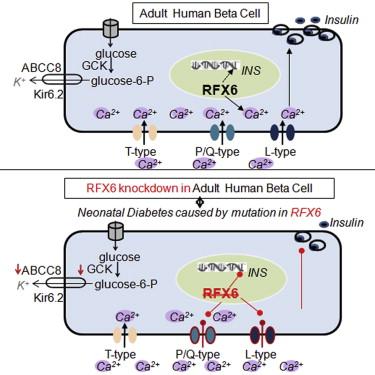 Nuevo tipo de Diabetes causada por la mutación del gen RFX6