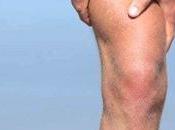 Cómo prevenir agujetas