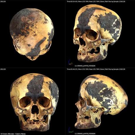El cráneo de la momia también estaba severamente deformado. Había sido aplanado en la parte superior y posterior de la cabeza en las regiones parietal y occipital
