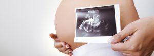 Epidurales durante el parto pueden proteger los músculos pélvicos Infección por estafilococo y embarazo