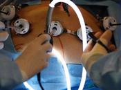 Cirugía Bariátrica puede producir Anemia Grave