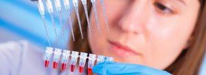 Lupus eritematoso discoide: síntomas y tratamiento