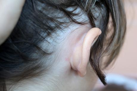 Cómo eliminar piojos y liendres de forma rápida Cómo eliminar piojos y liendres de forma rápida