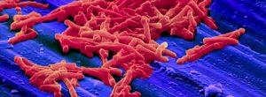 Superbug Clostridium Difficile está a punto de superar MRSA en hospitales