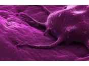 Mitos sobre tratamiento cáncer: ¿creer ellos