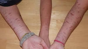 Automutilacion: Emociones dañinas Automutilacion: Emociones dañinas