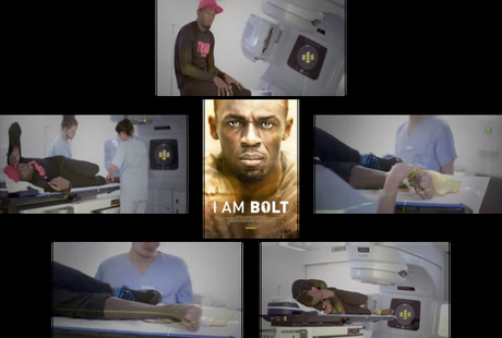 Radioterapia antiinflamatoria: lo que va de Eben Byers a Usain Bolt…