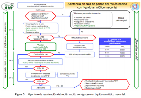 Recomendaciones para la reanimación neonatal (Resumen de varias guías)