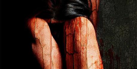 Microdermoabrasión para las estrías