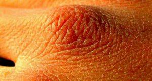 10 señales de que no bebes suficiente agua