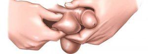 Los diez mitos de cáncer testicular más comunes
