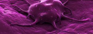 Un nuevo estudio muestra cómo las células pueden ser dirigidas hacia un camino no canceroso