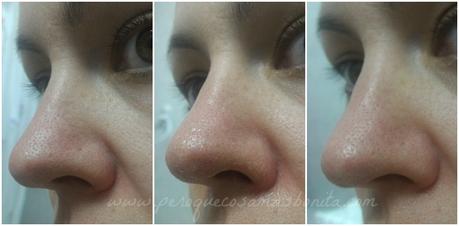 PoreDermabrasion de Dr Brandt