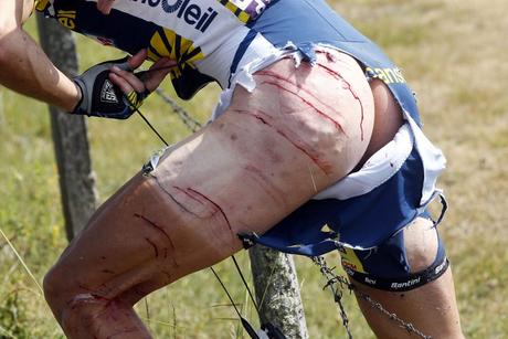 Por qué la mayoría de los ciclistas profesionales se depilan