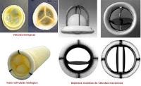 Las Válvulas Cardíacas Mecánicas son más seguras que las Biológicas