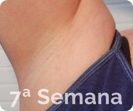 antes despues philips lumea