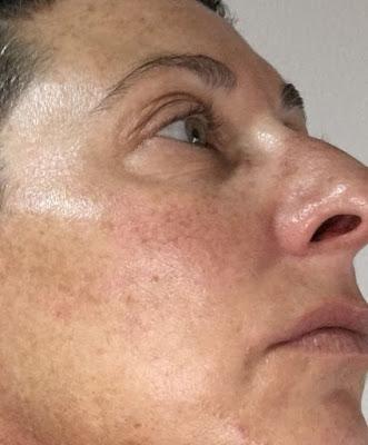 Tratamiento Regenerador Antiaging. Elisabeth Vargas Cosmetic. MODO DE EMPLEO y RESULTADOS!!