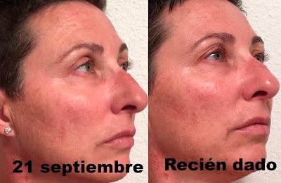 Tratamiento Regenerador Antiaging. Elisabeth Vargas Cosmetic. MODO DE EMPLEO y RESULTADOS!!