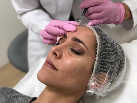 Fitness And Chicness-Tratamiento Acido Hialuronico Dra Ana Maldonado-3