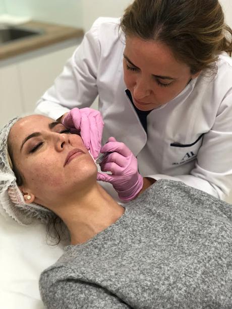 Fitness And Chicness-Tratamiento Acido Hialuronico Dra Ana Maldonado-5