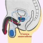 Implantan Uretra Desarrollada en el Laboratorio