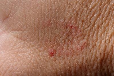 Culebra bastarda (Malpolon monspessulanus)