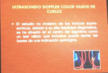 Doppler de vasos del cuello segunda parte Doppler de vasos del cuello segunda parte