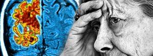 5 Tratamientos alternativos para la enfermedad de Alzheimer